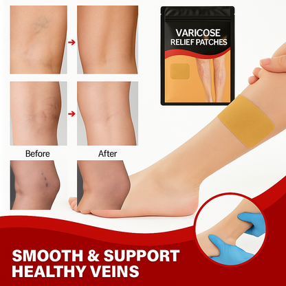 Varicose vein Patches - Pack of 12pcs (1 + 1 Free)